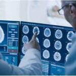 Global Artificial Intelligence in oncology market Research Report