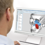 Global Virtual Surgical Planning Market Research Report