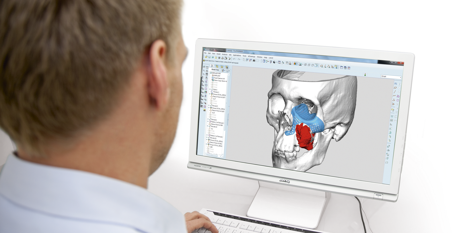 Global Virtual Surgical Planning Market Research Report