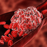 Overview of the Venous Thromboembolism (VTE) Therapeutics Market