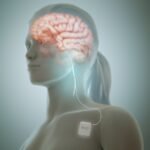 The Science Behind Vagus Nerve Stimulation: A Breakthrough in Neurological Care